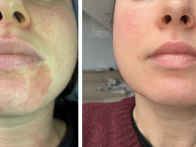 Screenshot 2025-03-04 at 4.36.13 PM